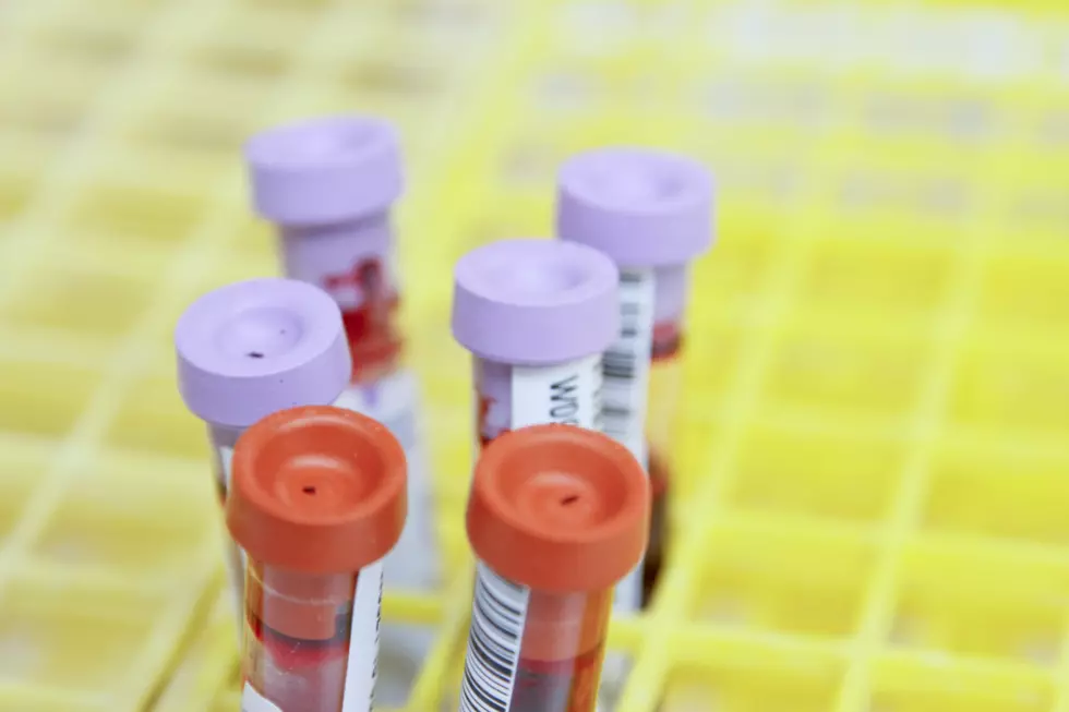 medical blood collecting tubes, lavender and orange tops, in a yellow test tube holding rack.